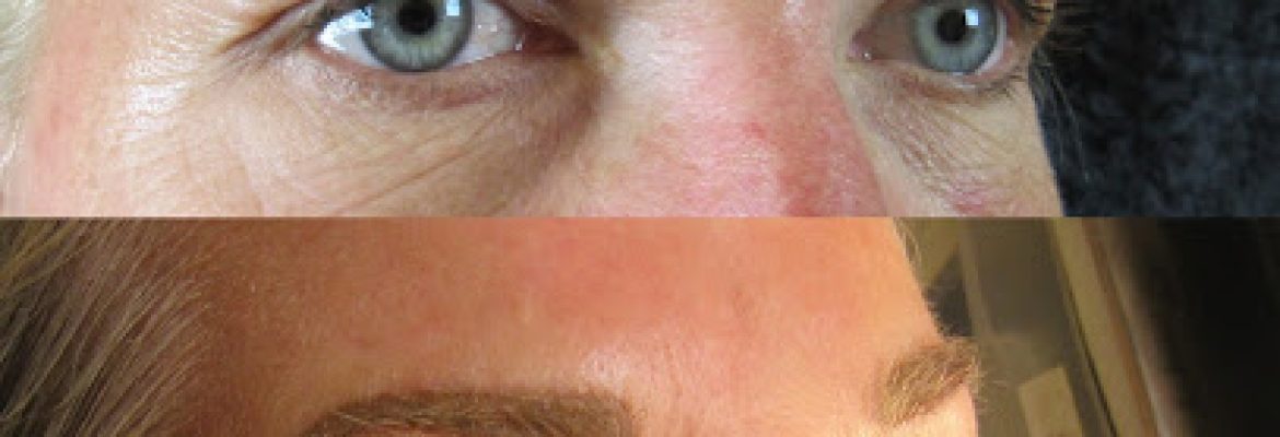 Exceptional EveR After Permanent Cosmetics & Skin Care