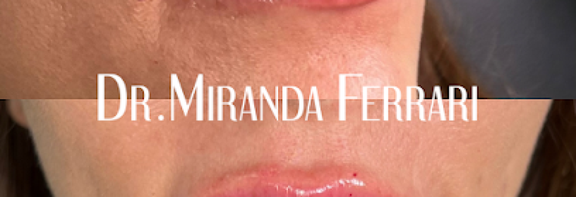Ferrari Facial Aesthetics