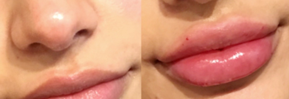 Fresh Faces RX | Advanced Aesthetics in Portland | Dr Jodee M Anderson MD